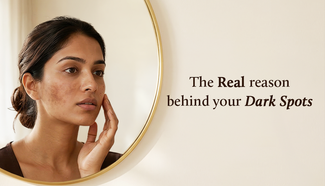 A woman looking at her reflection in a round mirror, gently touching her face with visible dark spots on her cheeks, set against a soft neutral background with the text “The Real reason behind your Dark Spots” on the right side.