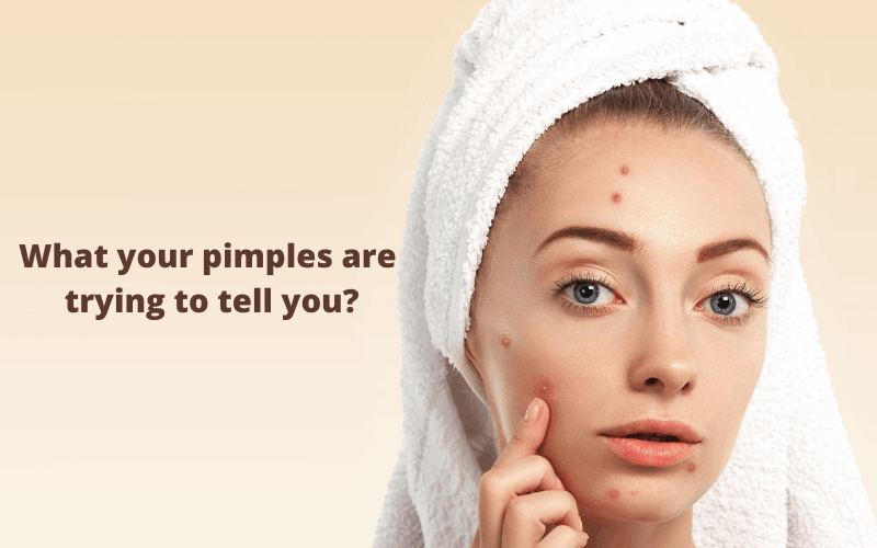 Worried lady is touching her pimples that is on her face 