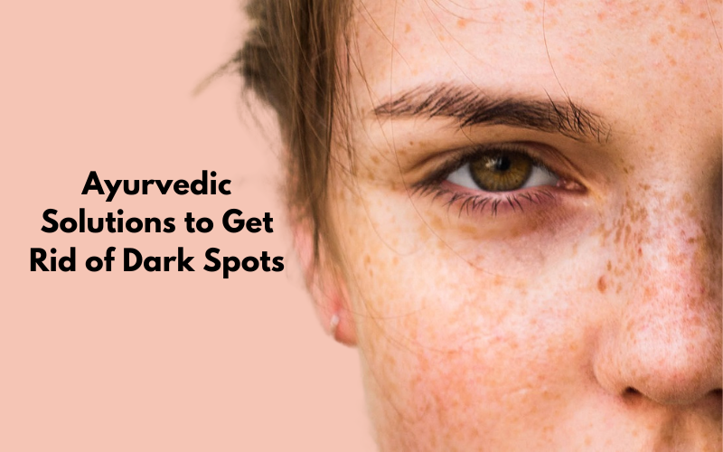 Dark spots on face? Ayurveda has you covered