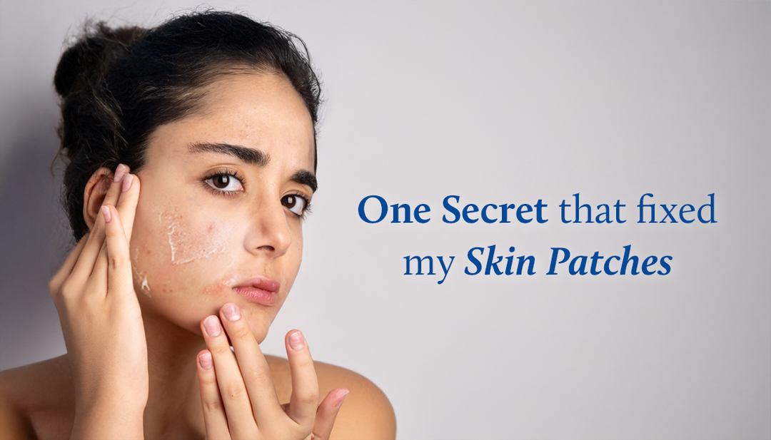 Lady looks closely at her reflection, noticing uneven skin patches on her face.