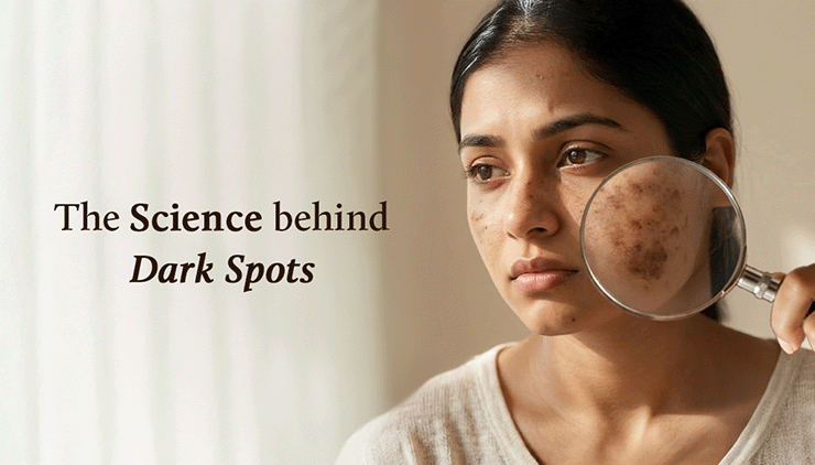 Still Asking What Is the Reason of Dark Spots on Face? This Guide is for you