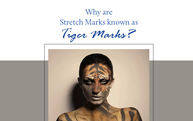 stretch marks or tiger marks on face 