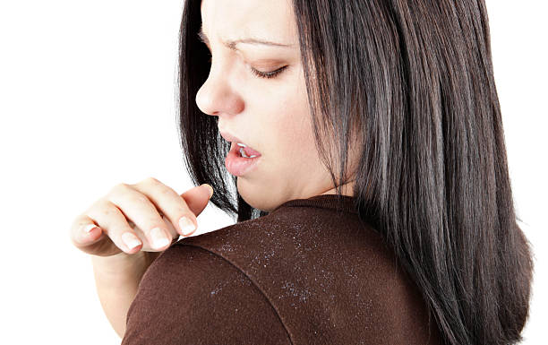 5 Dandruff Myths You’re Still Believing (And What Ayurveda Really Says)