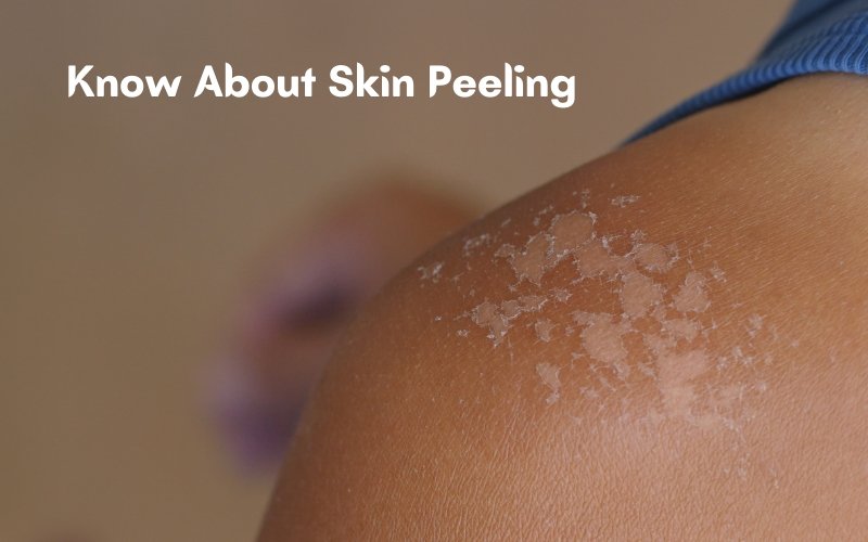 Everything You Need to Know About Skin Peeling - Blue Nectar Ayurved