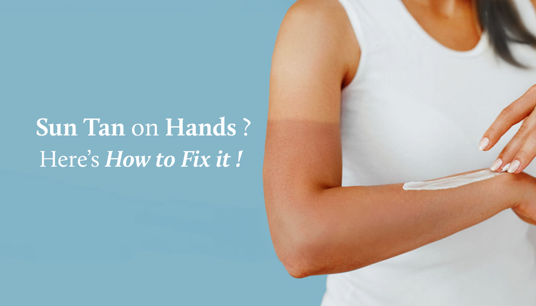 How to remove Tan from hands?