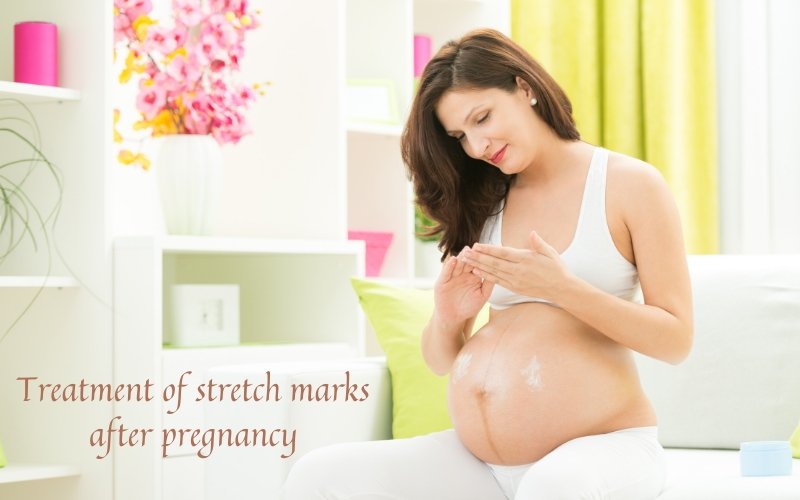 Prevent stretch marks during pregnancy..possible? - Blue Nectar Ayurved