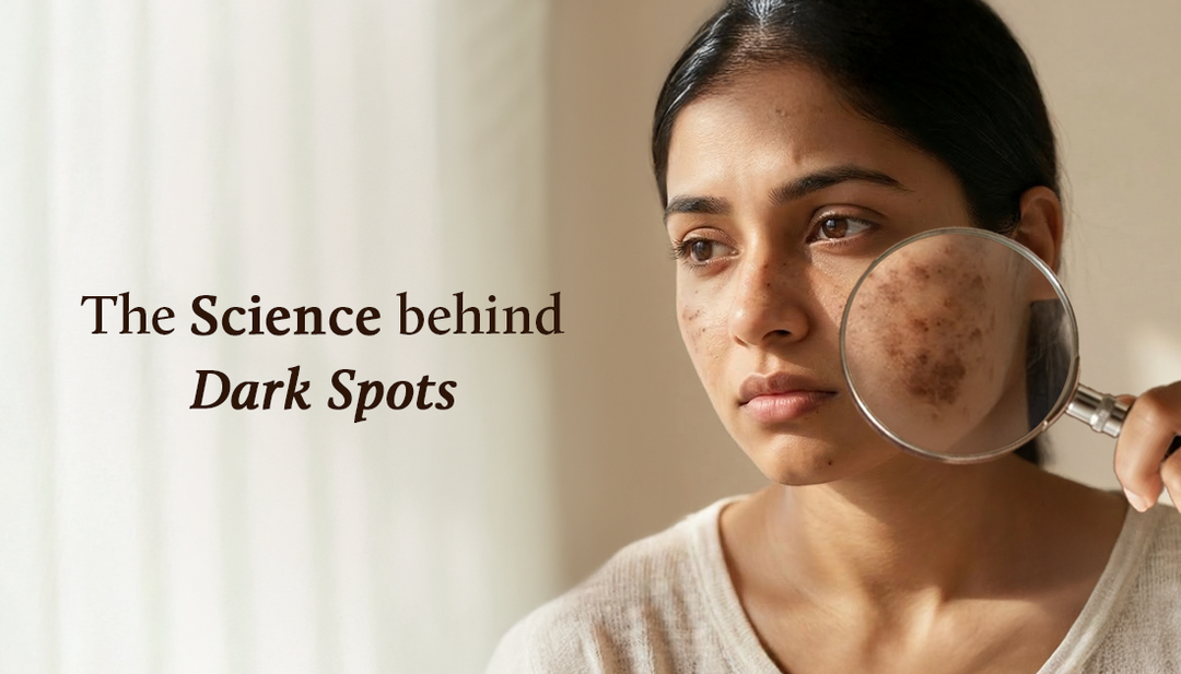 A close-up of a woman with visible dark spots on her face, looking to the side, while a magnifying glass highlights hyperpigmentation on her cheek. The image includes the text “The Science behind Dark Spots” on a soft, minimal background.