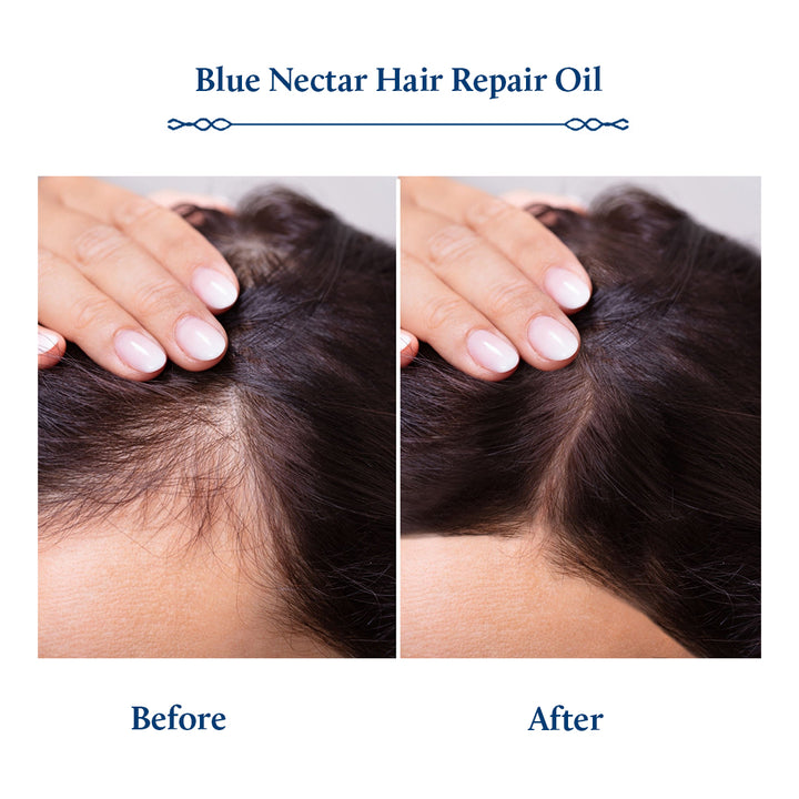Blue Nectar Rosemary Hair Oil with Plant Based Alternate to Redensyl for Hair Growth (9 herbs, 100ml)