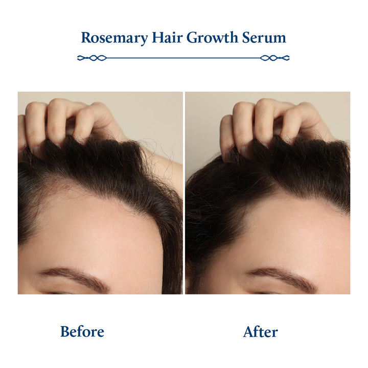 Rosemary Hair Growth Serum with Plant Based Alternate to Redensyl for Hair Growth (8 Herbs, 100ml)