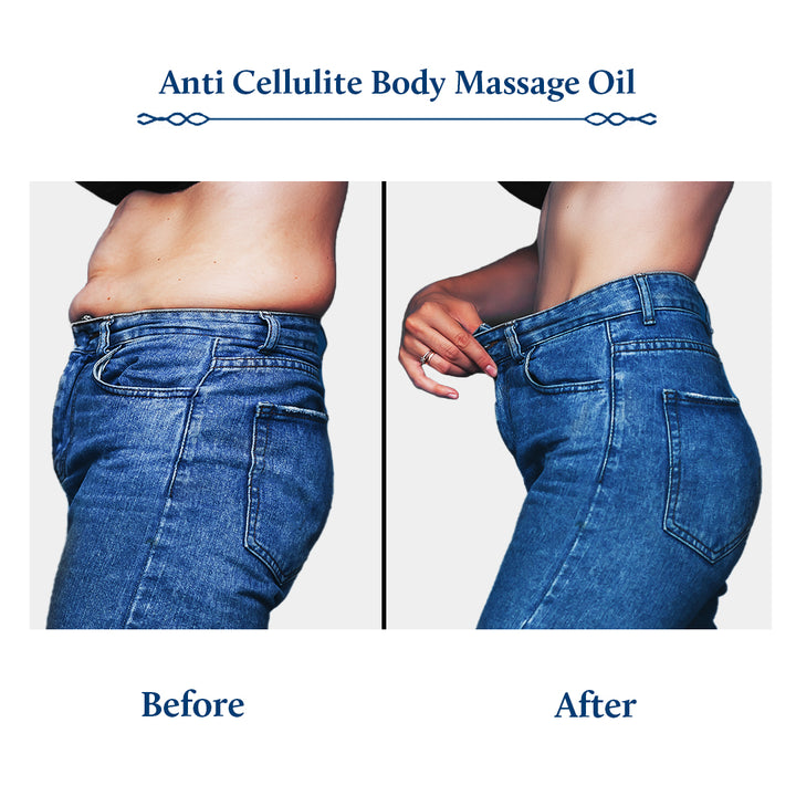 Triphaladi Ayurvedic Slimming and Anti-Cellulite Massage Oil