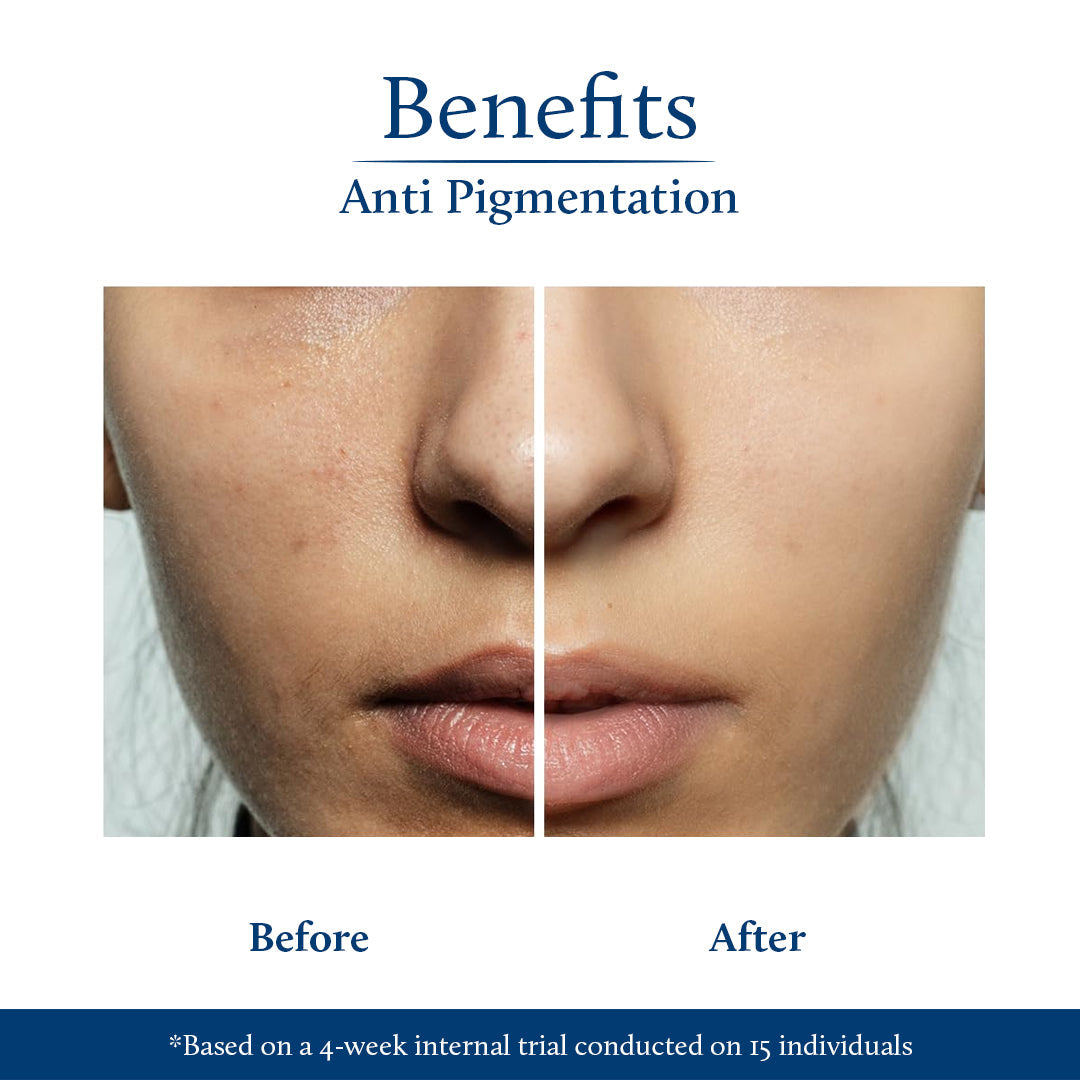 Before After Kojic Acid