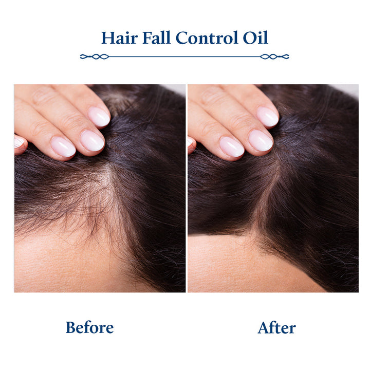 Before and after effects of hair fall control oil