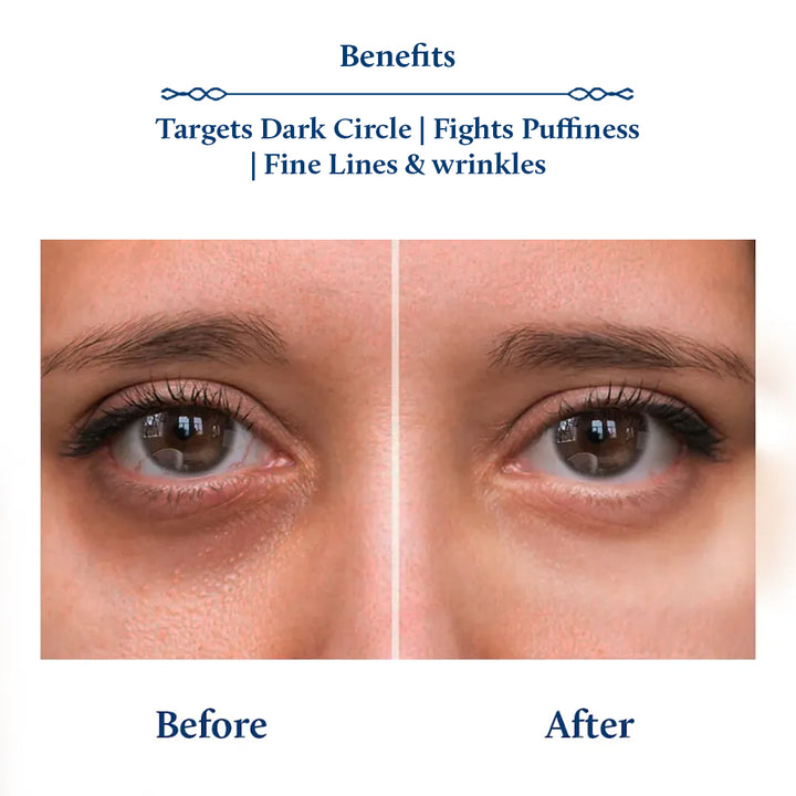 Target Dark Circles