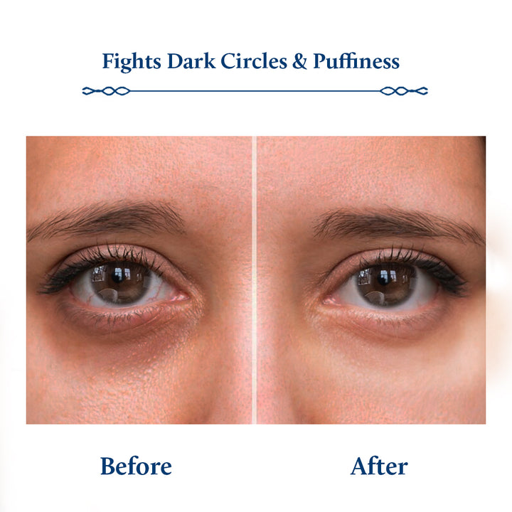 Fights dark circles and under eye puffiness